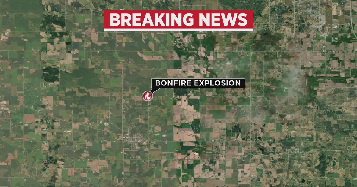 Bonfire explosion in Wisconsin leaves several teens hospitalized CBS