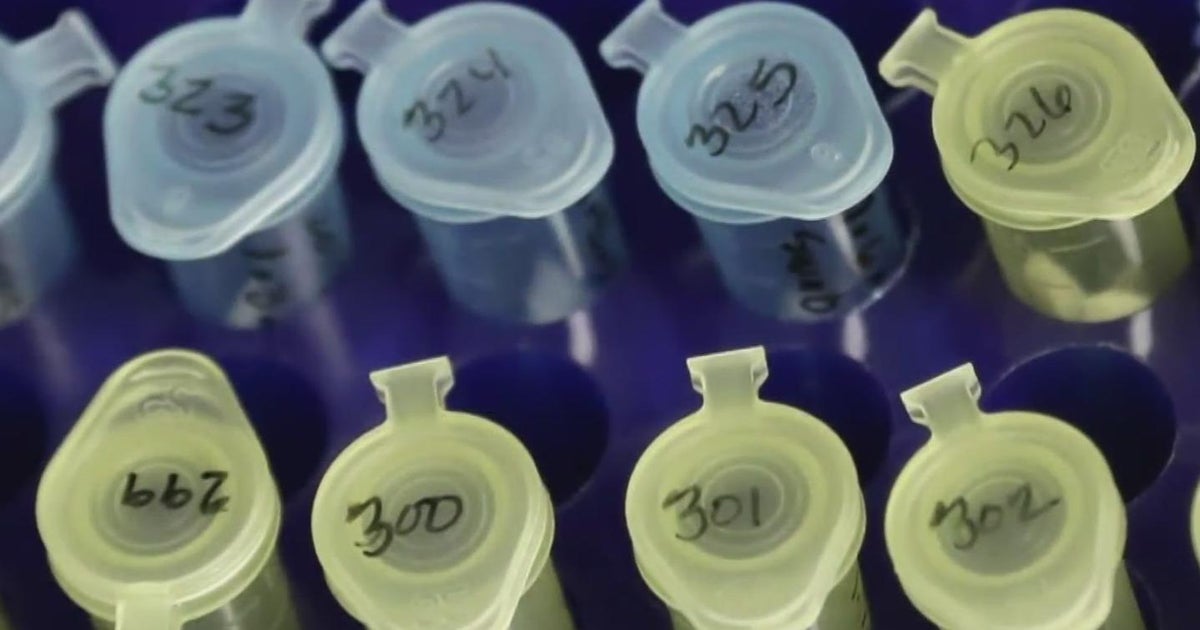 Sexual assault victim talks about having DNA from her rape kit used against her by police - CBS San Francisco