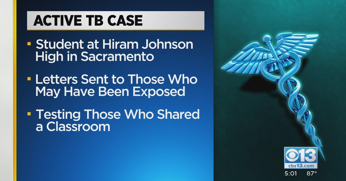 Hiram Johnson student diagnosed with tuberculosis