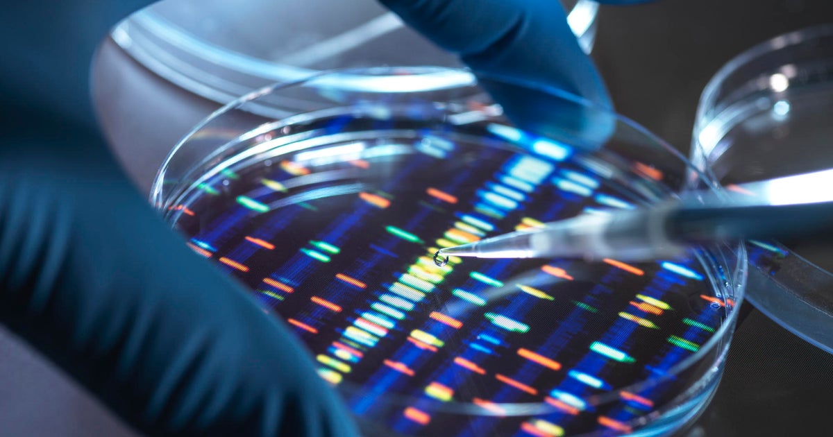 Dispelling Myths about Inherited Cancer and Genetic Testing - CBS Baltimore