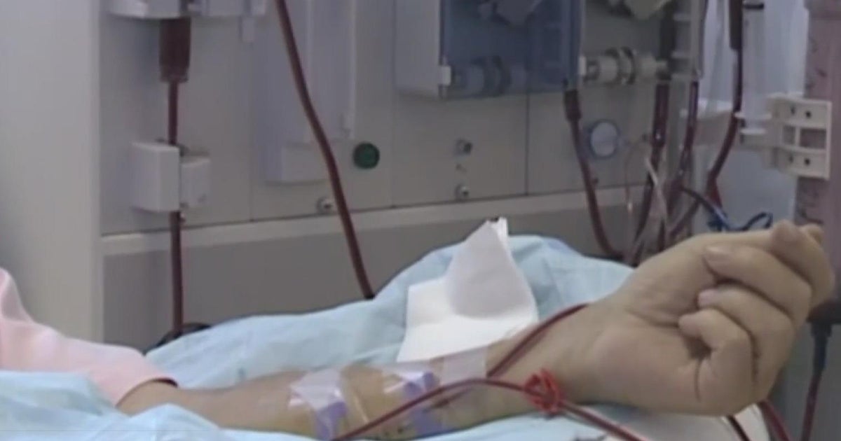 Prop 29: California voters considering a ballot measure for dialysis clinics