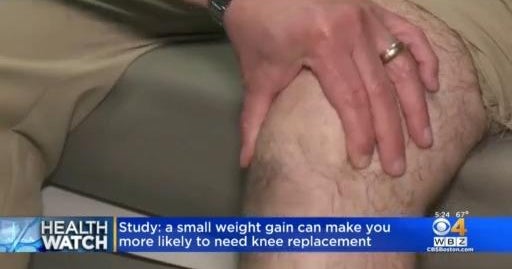 Gaining weight could increase risk of knee surgery CBS Boston