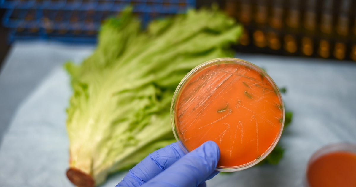 Listeria outbreak How to protect yourself from the deadly foodborne