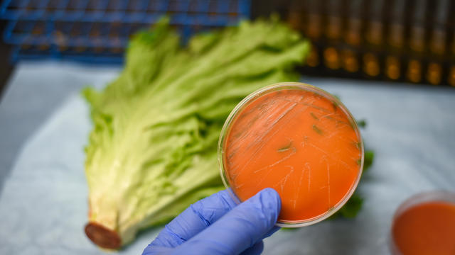 Listeria bacterial culture plate isolated from romaine lettuce vegetable 