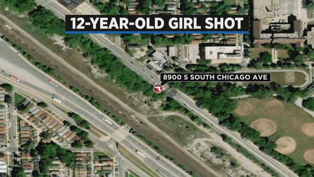 12-year-old girl shot in South Shore 