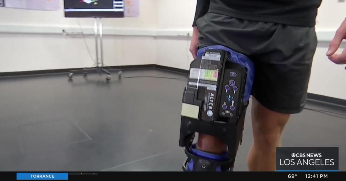 Bionic Leg Tests Show Promise For Stroke Recovery Cbs Los Angeles 5289