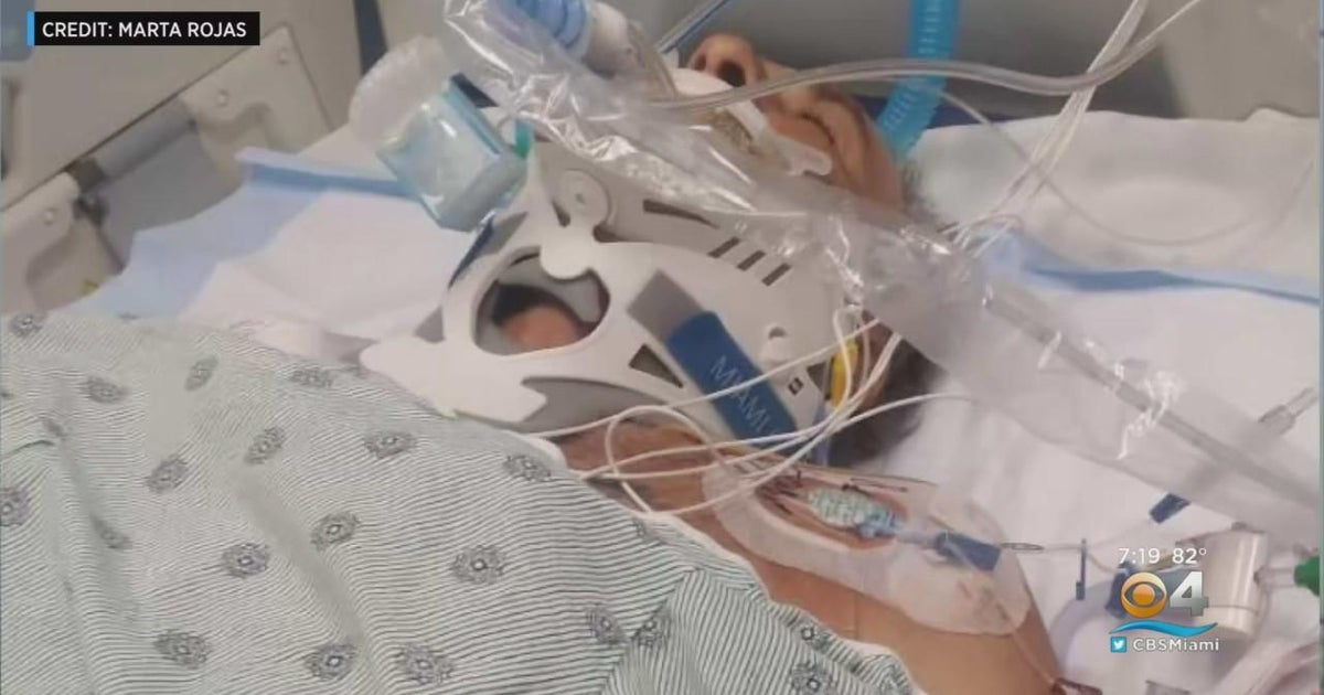 Wife seeks answers in hit-and-run that nearly killed husband - CBS Miami
