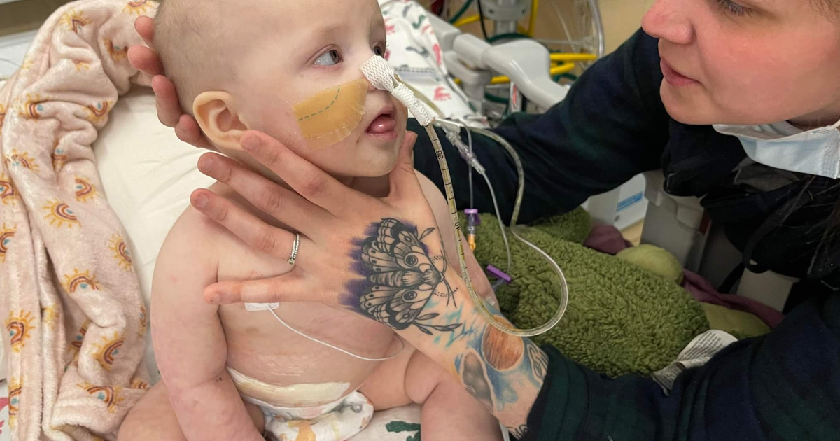 Child ate deals orbeez