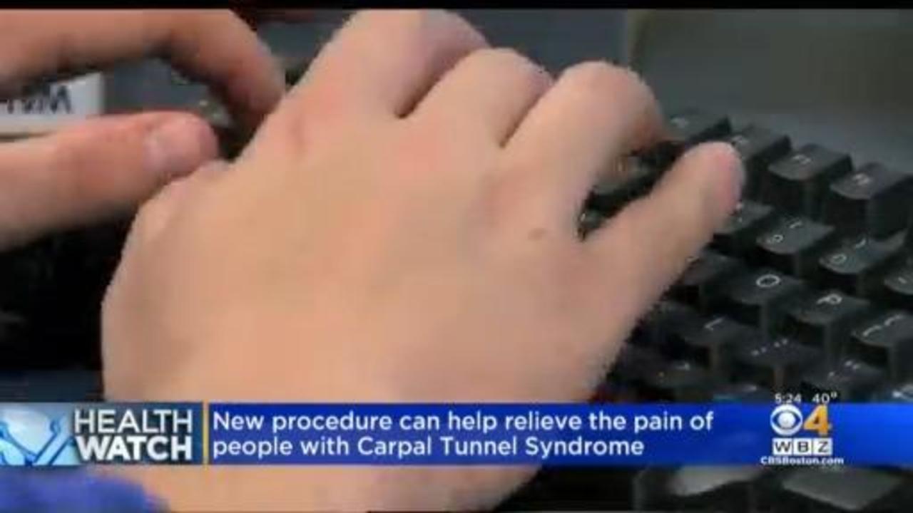 5 Ways to Avoid Carpal Tunnel Syndrome