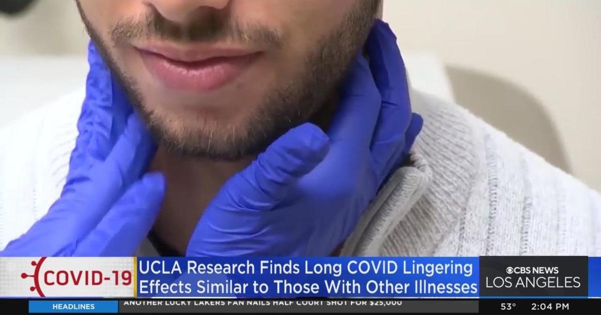 Long COVID effects are similar to other lingering illness symptoms