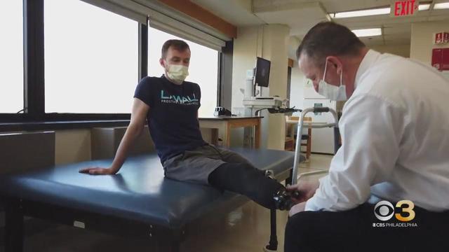 injured-ukrainian-soldier-receives-life-changing-therapy-in-delaware-county.jpg 