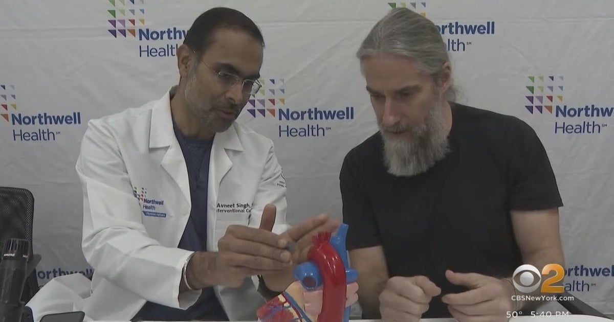 Queens storm-chaser shares warning signs after experiencing stroke