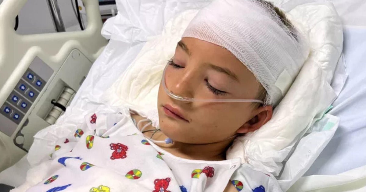 8-year-old Colorado boy fighting for his life after horseback riding ...