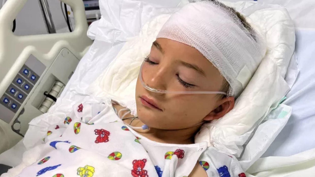 8yearold Colorado boy fighting for his life after horseback riding(01)