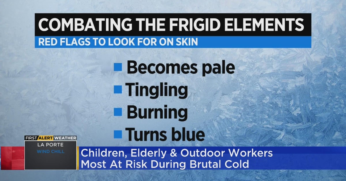 Expert warns what red flags to look for when exposed to extreme cold ...