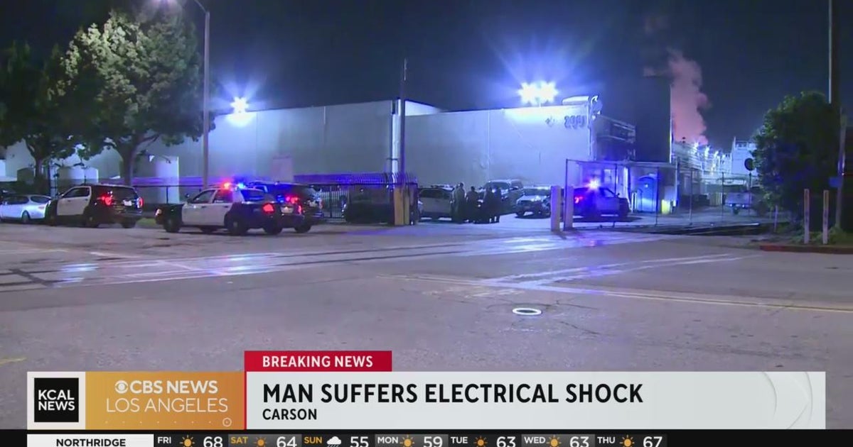Electrical shock victim at Carson business hospitalized CBS Los Angeles