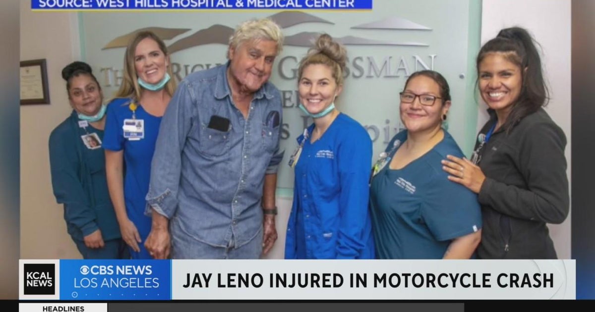Comedian Jay Leno injured in motorcycle crash CBS Los Angeles