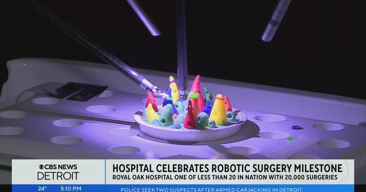 Royal Oak Hospital Celebrates Robotic Surgery Milestone - CBS Detroit