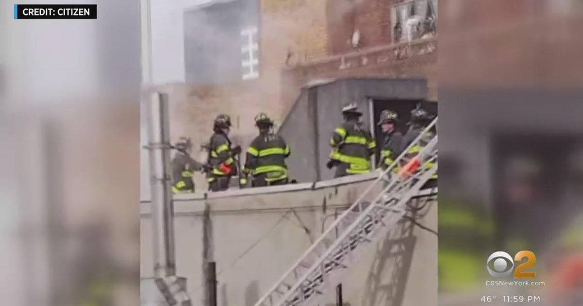 3 children injured in Inwood fire - CBS New York