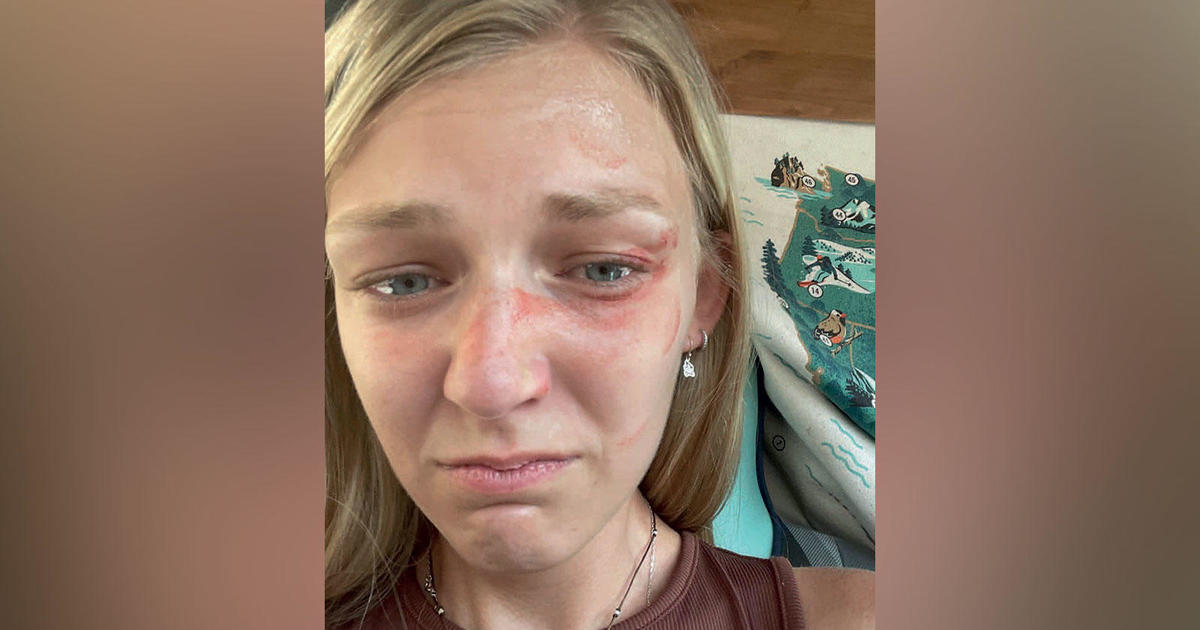 Selfie taken by Gabby Petito demonstrates she had a facial injuries on the day she was interviewed by Moab police in excess of domestic disturbance connect with, lawyer says