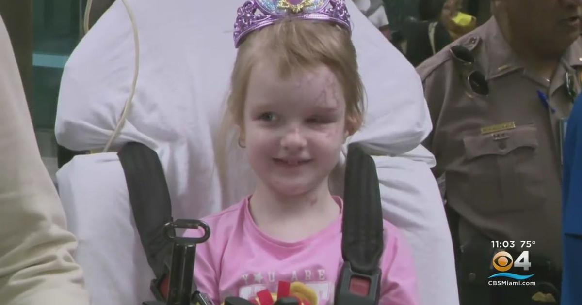 6 Year Old Girl Being Treated In South Florida Following Ukrainian Blast Injuries Cbs Miami