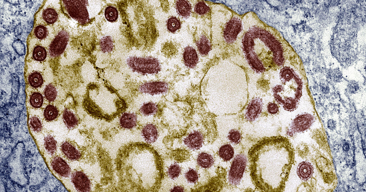 WHO Calls Urgent Meeting Over Marburg Virus Outbreak