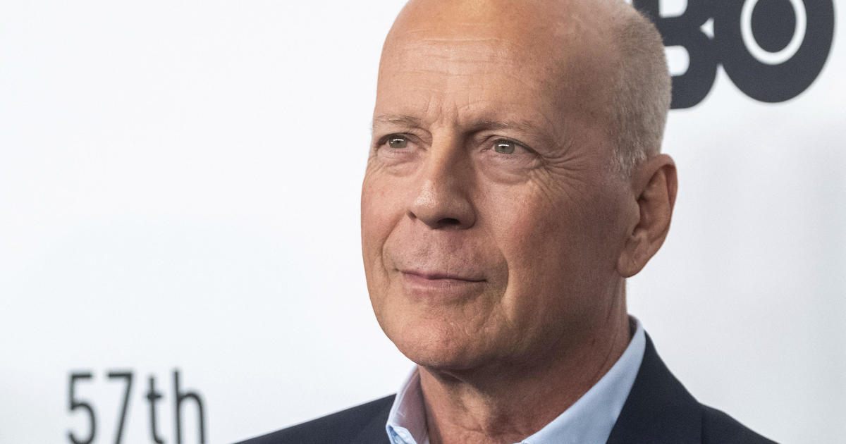 Bruce Willis' features will get "worse," could require in-home care as frontotemporal dementia progresses, Dr. Agus says