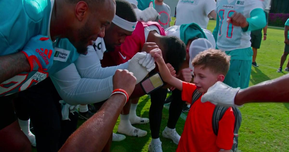 6-year-old who beat cancer twice to take part in Saturday's Dolphins  Challenge Cancer - CBS Miami