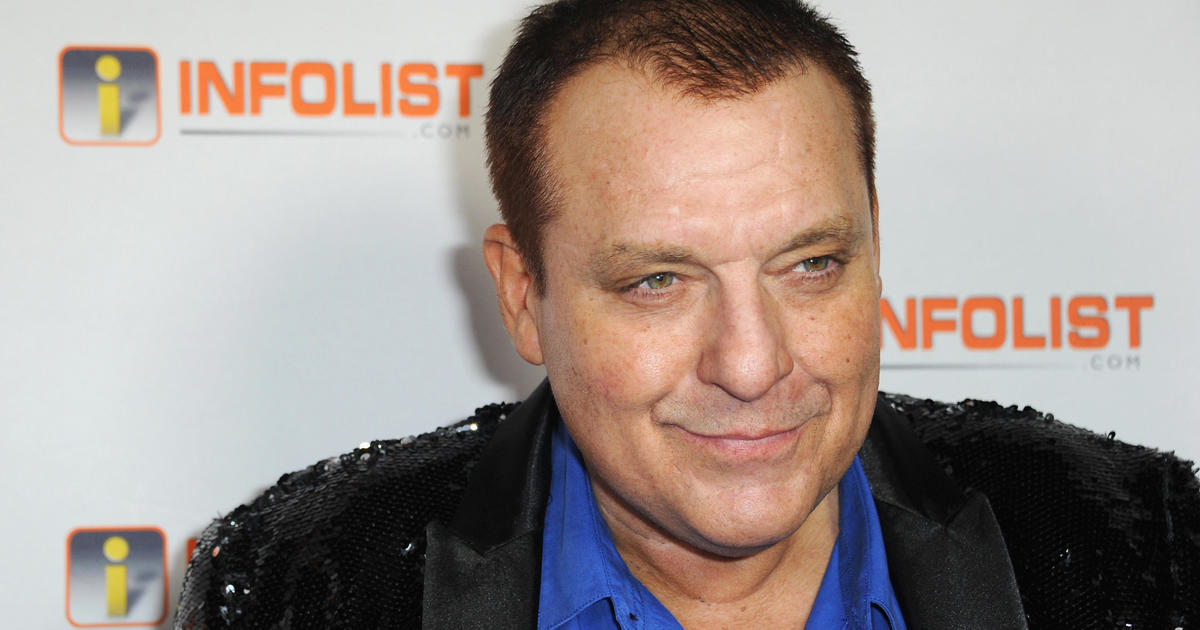 Tom Sizemore’s family told there’s “no further hope” after brain aneurysm leaves actor in critical condition, manager says