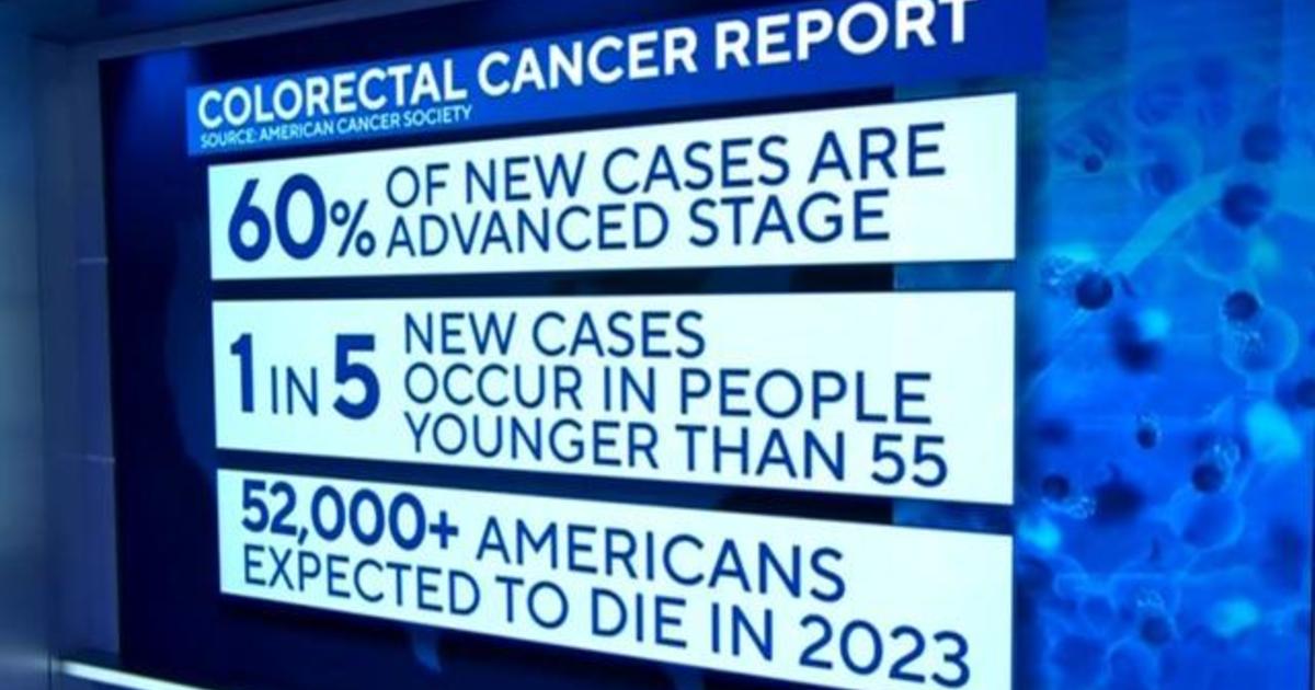 Colon cancer rates rising in younger people, report finds