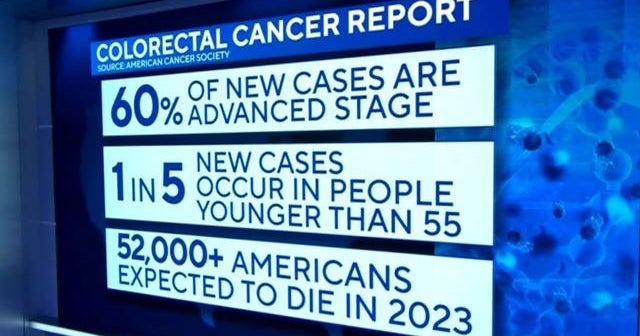 Why Early-Onset Cases Are Increasing Why Early-Onset Cases Are Increasing