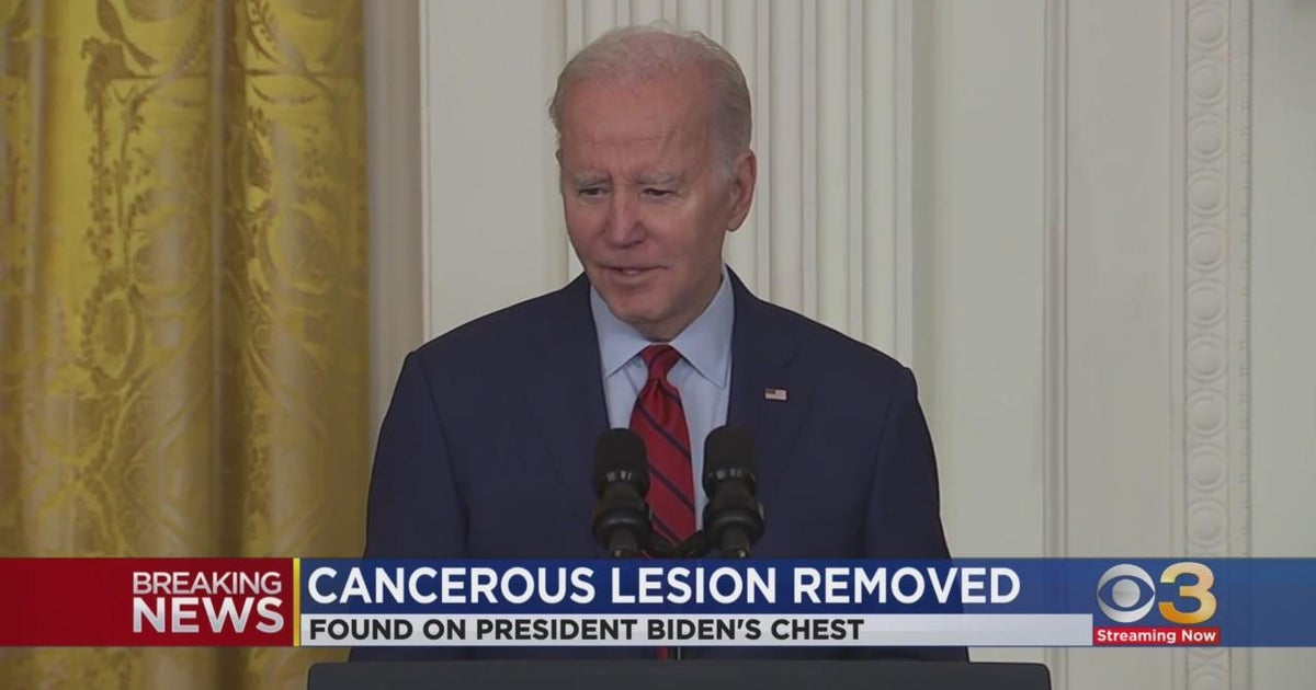 Biden had skin lesion with cancerous tissue removed last month, doctor