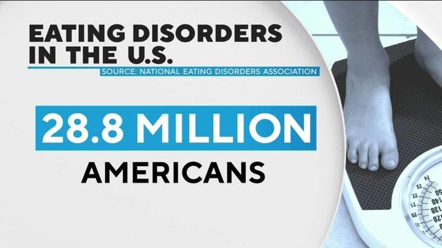 eating-disorders-stats-1.jpg 