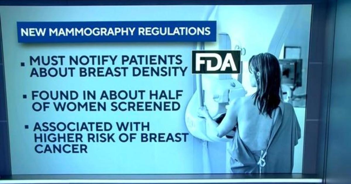 FDA unveils new rules for mammograms