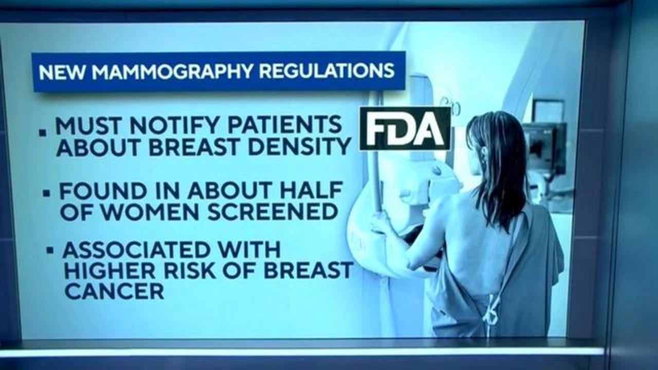 Medical practitioners will have to notify patients about breast density in  mammograms under new FDA regulations - CBS News