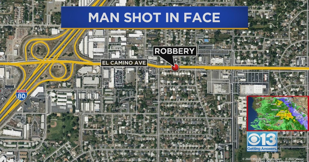 Man shot in the face during robbery in Sacramento - CBS Sacramento