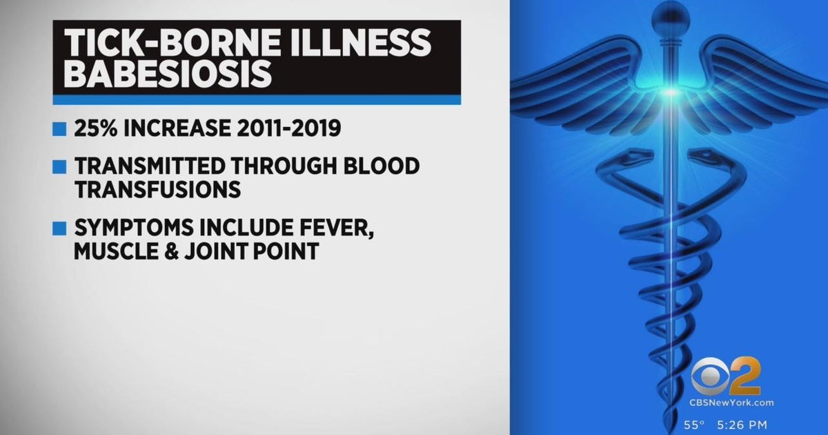 Tick-related disease cases on the rise in Tri-State Area - CBS New York