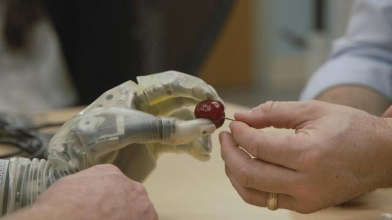 Prosthetic Science Creates Replacement Limbs In Texas
