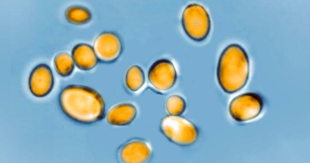 California is the state with the 2nd most superbug fungus infections