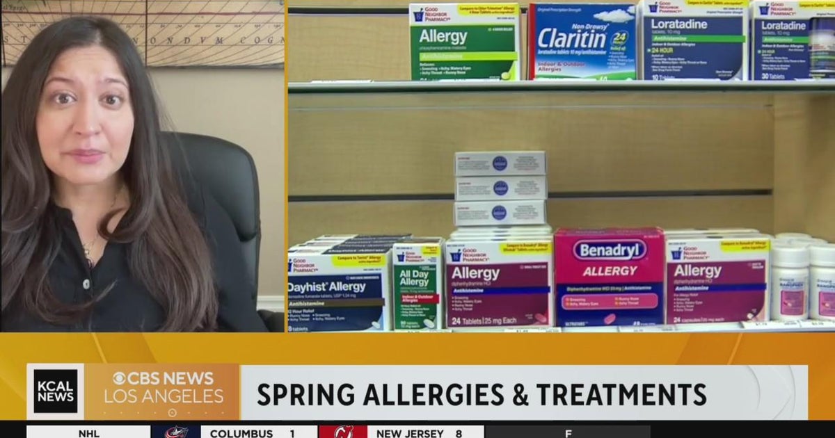 How to deal with springtime allergies CBS Los Angeles