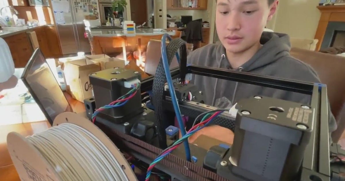 North Bay teen’s 3D printing project could soon save lives - CBS San Francisco