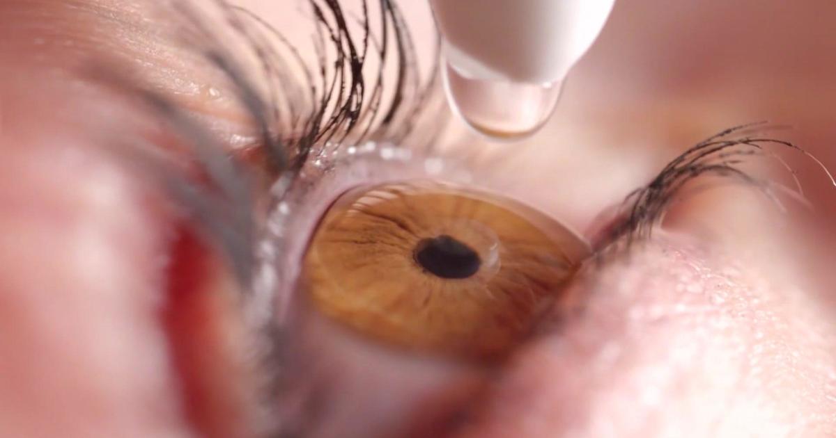 FDA warns of contaminated copycat eye drops