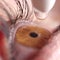 FDA warns of contaminated copycat eye drops