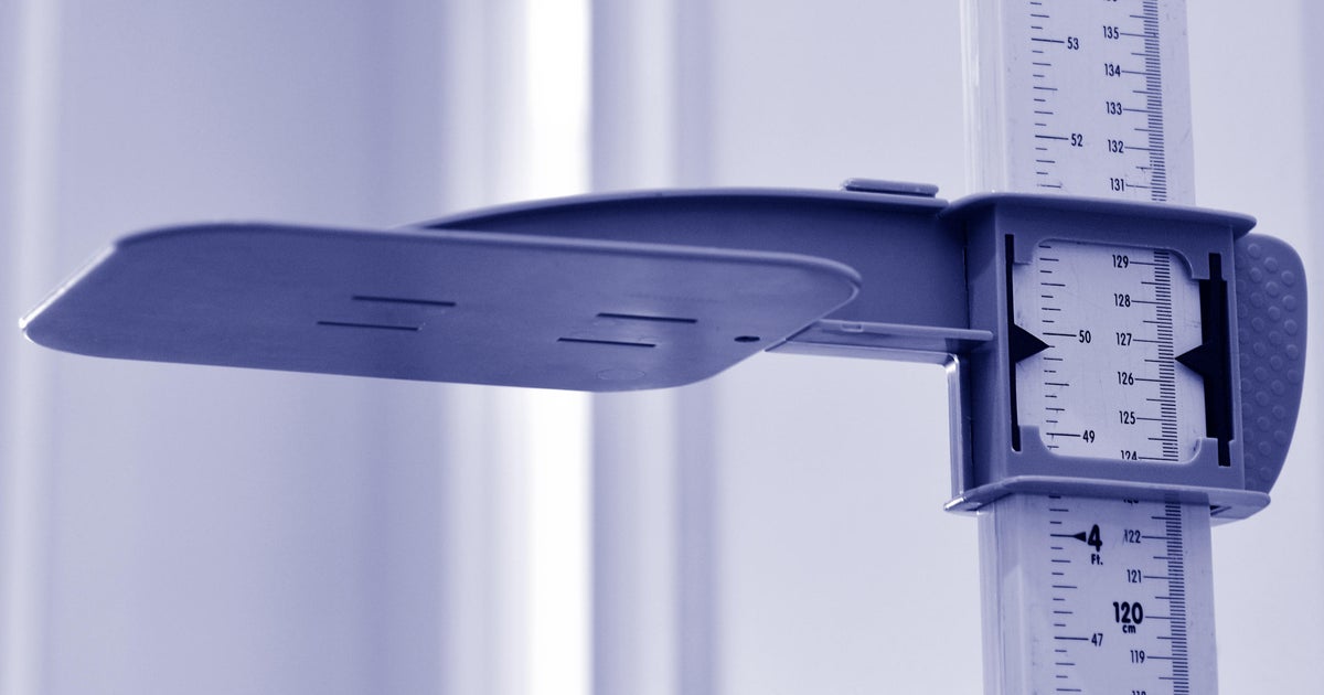 Limb Lengthening: A cosmetic height surgery that's gaining popularity ...