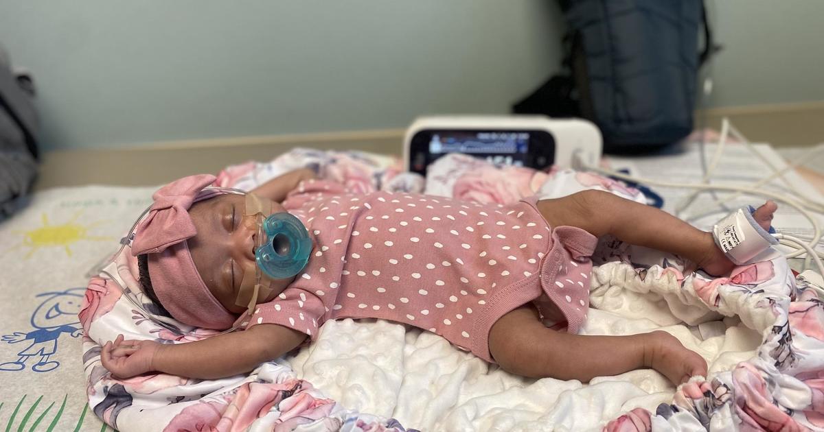 doctors-performed-brain-surgery-on-a-baby-before-she-was-born-now-she