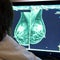 Feds cancel plan that risked limiting breast reconstruction options