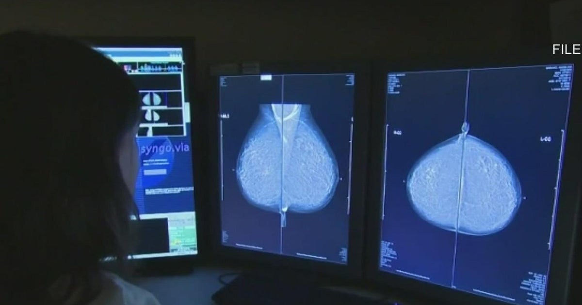 New Hispanic Breast Cancer Clinic at Northwestern aims to improve access to care New Hispanic Breast Cancer Clinic at Northwestern aims to improve access to care