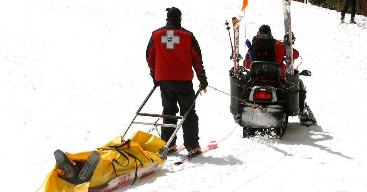 I tipped over a snowmobile and it crushed my leg, when I fell off