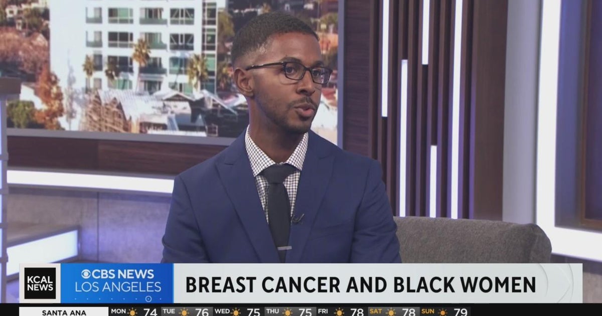 Breast cancer death rate highest in black women - CBS Los Angeles
