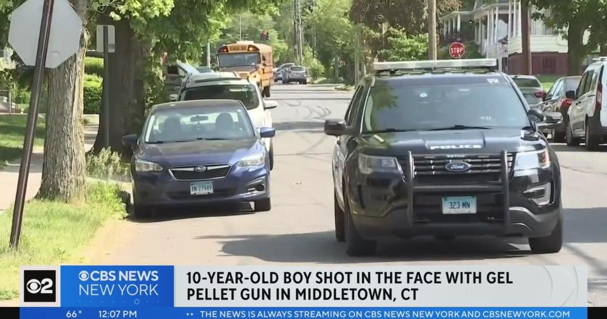 Connecticut boy shot in face with pellet gun